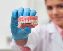 What Are the Advantages of Dental Implants?