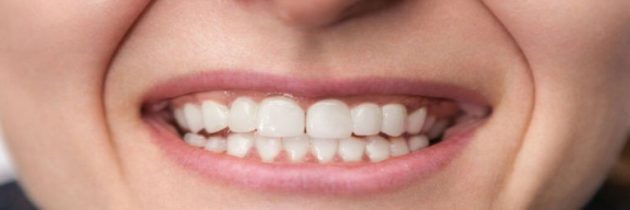 Achieve a Brighter Smile with Teeth Whitening in Macon, GA