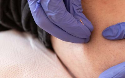 The Connection Between Spinal Health and Sports Performance: Why Spinal Decompression Matters