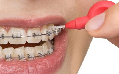 Straighten Your Smile with Invisalign Dental Treatment Taylorsville, KY Residents Trust
